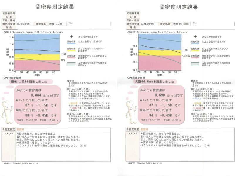 2024.03.07DXA骨密度測定結果