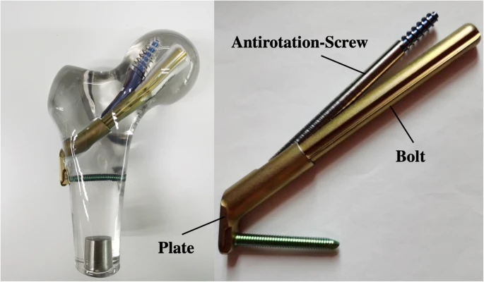 Femoral Neck System